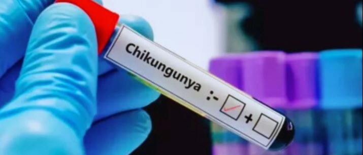 La Guyane se prépare à une épidémie de chikungunya.
