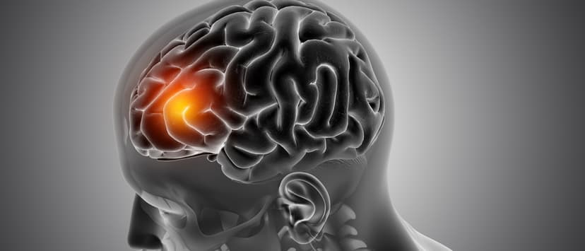 Contre les AVC, se faire prendre la tension à la maison.